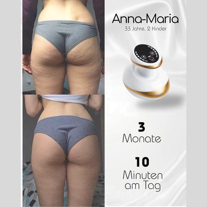 Anti-Cellulite-Gerät mit Wärme- und Massagefunktion