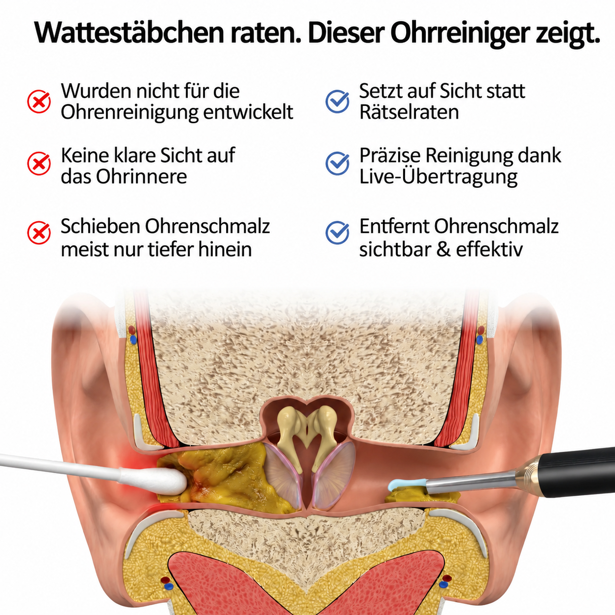 Nettoyeur d’Oreilles Visuel HD avec Caméra Intégrée