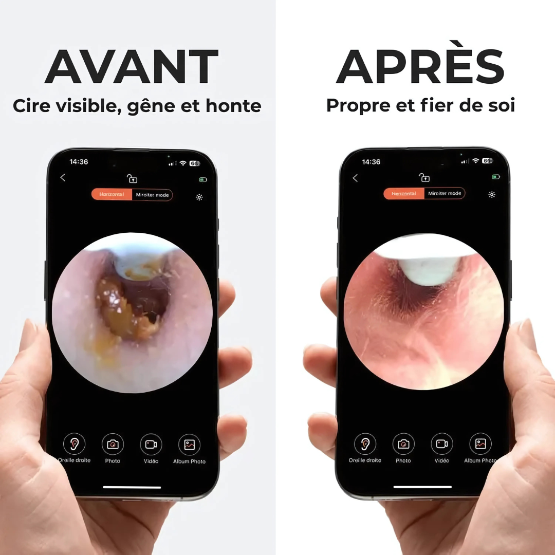 Kit Nettoyage Oreilles avec Caméra HD
