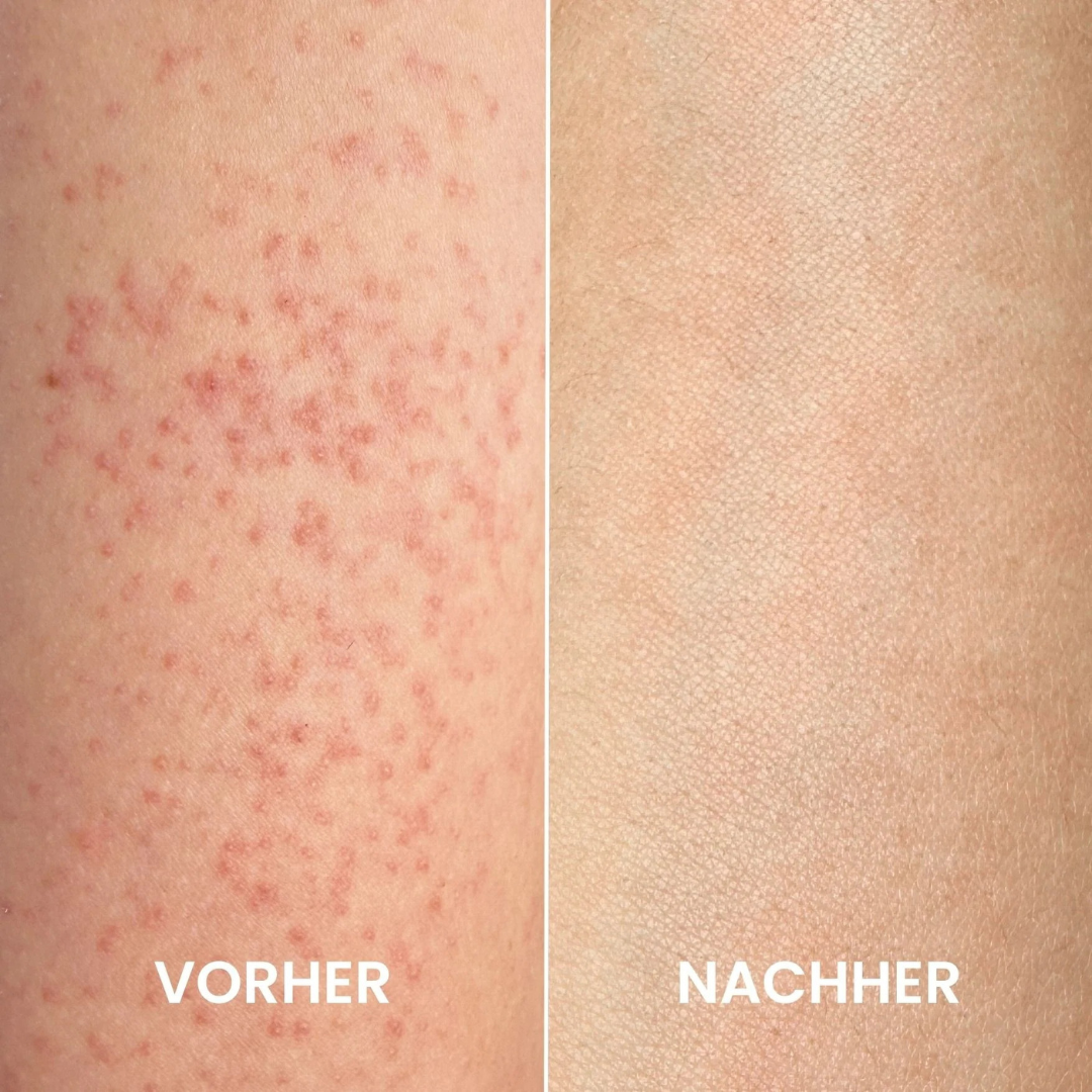 Gant exfoliant réutilisable pour une peau douce et lisse