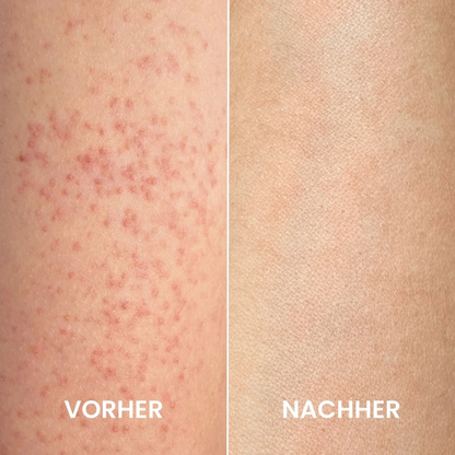 Gant exfoliant réutilisable pour une peau douce et lisse