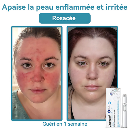 Stylo Soin Anti-Taches