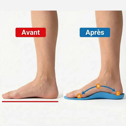 Semelles de soutien plantaire
