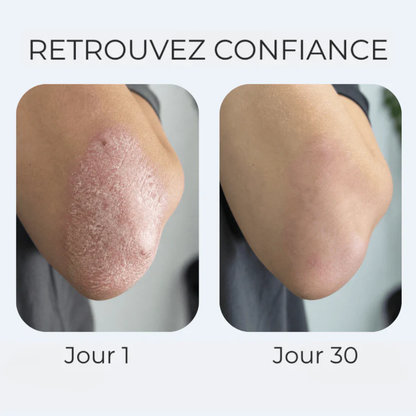 Crème anti-démangeaisons naturelle multi-zones
