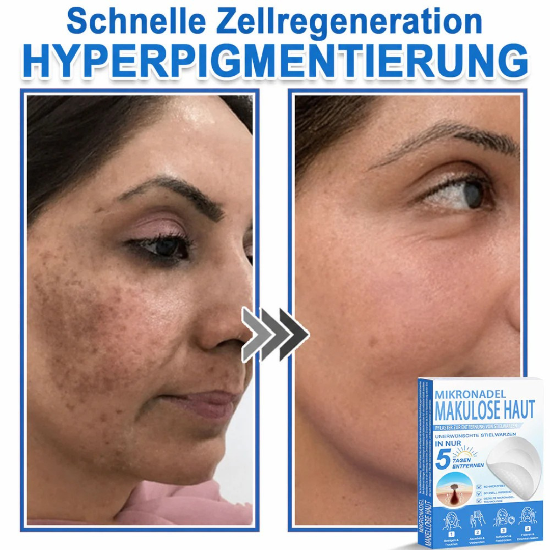 Patchs micro-aiguilles anti-boutons et imperfections visage