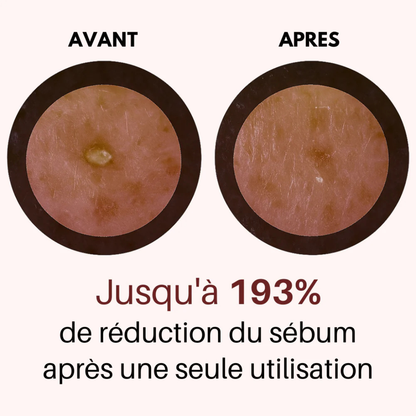 Exfoliant au riz