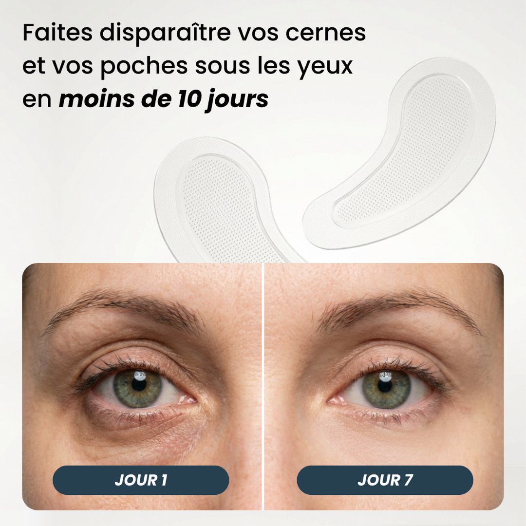 Anti-Augenringe-Patches mit Mikronadeln