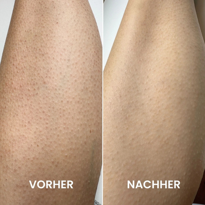 Gant exfoliant réutilisable pour une peau douce et lisse