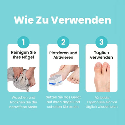 FungiClear Pro™ – Lasergerät gegen Nagelpilz