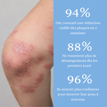 Crème anti-démangeaisons naturelle multi-zones