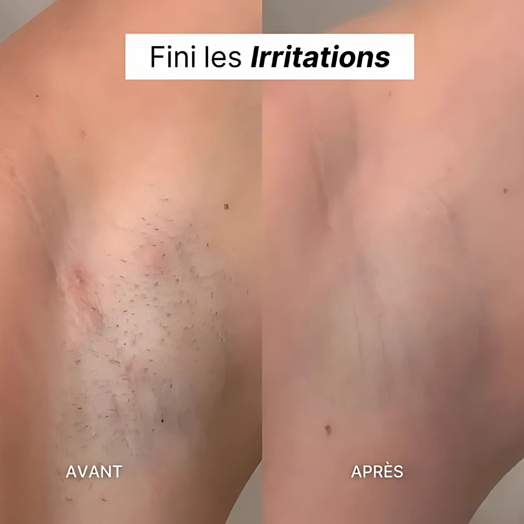 Rasoir Électrique Précision