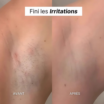 Rasoir Électrique Précision