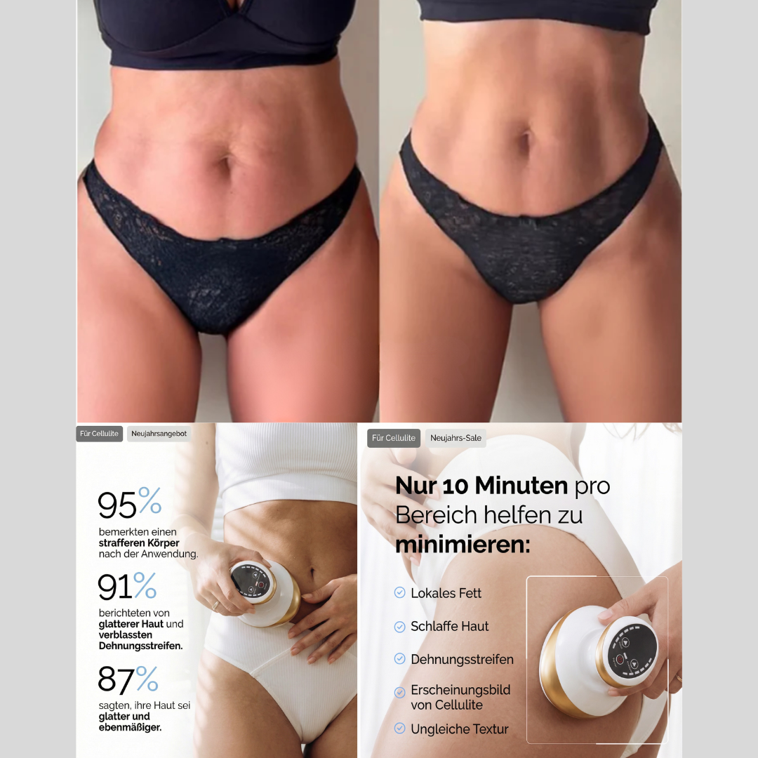 Anti-Cellulite-Gerät mit Wärme- und Massagefunktion