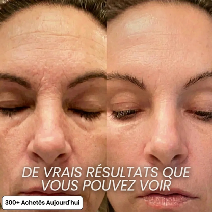 Stick collagène PDRN anti-âge visage