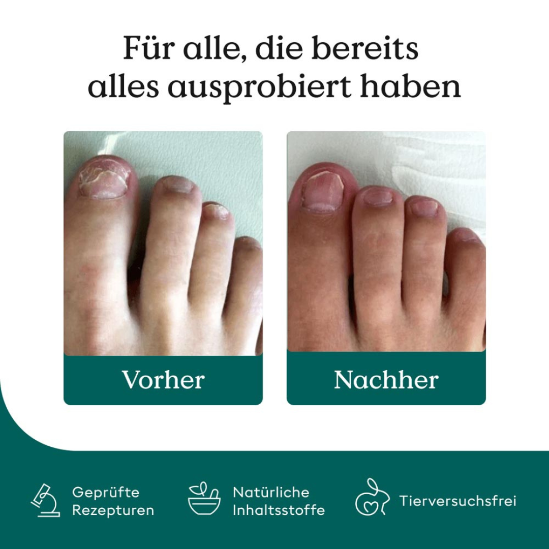 Reparierende Pflege für brüchige Nägel