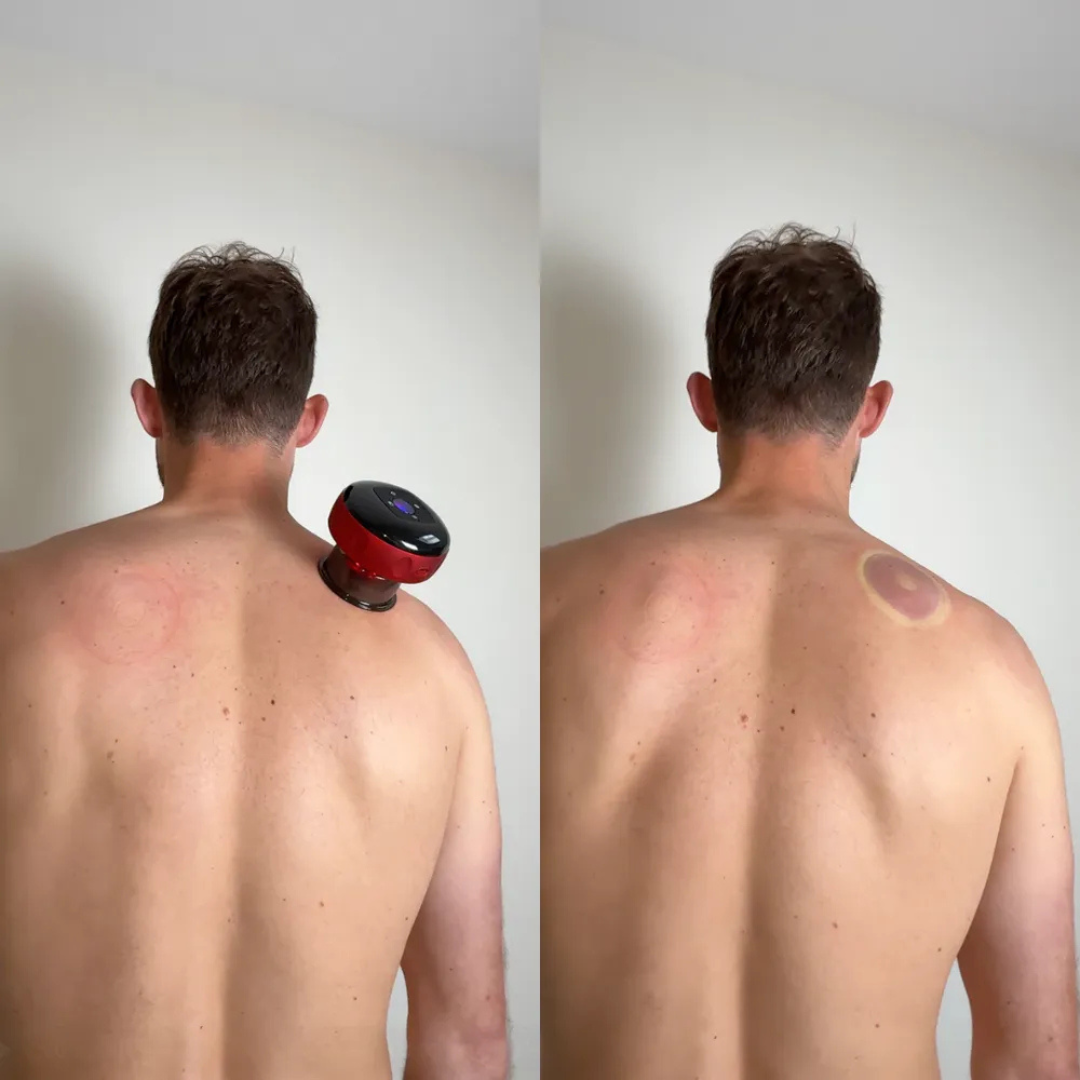 Masseur à Ventouse Intelligent