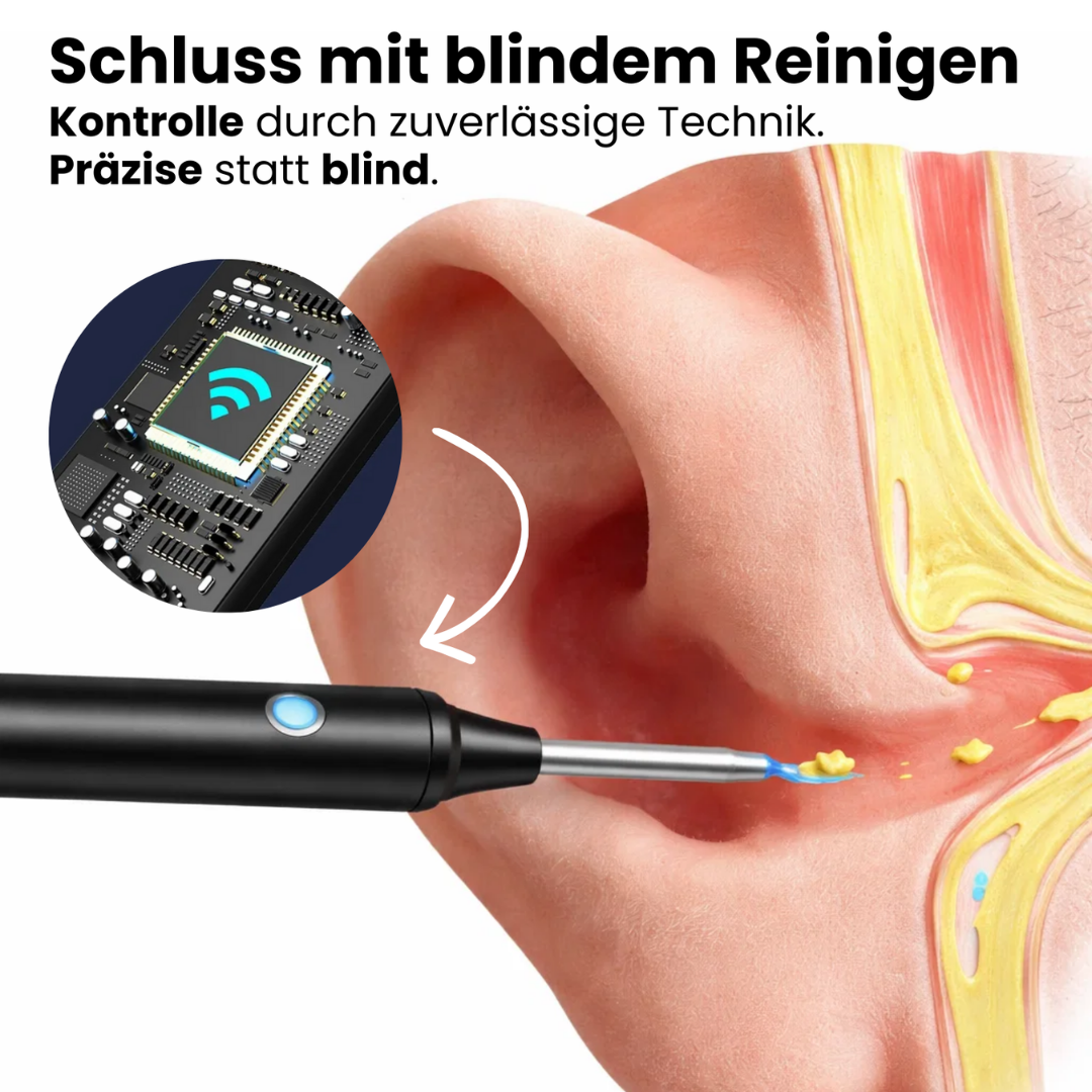 HD-vernetztes Otoskop zur Ohrreinigung