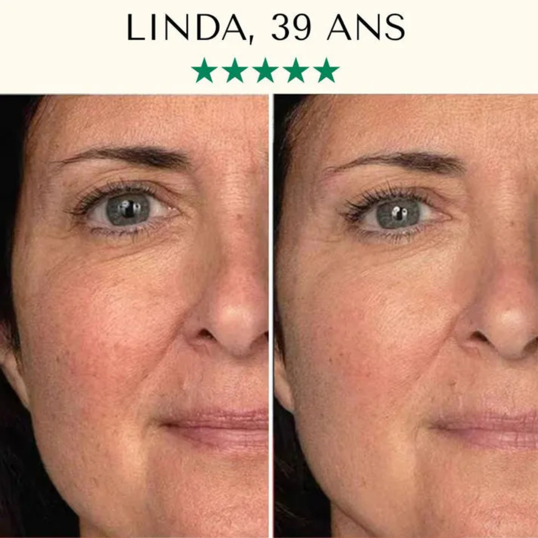 Appareil nettoyant visage à ultrasons