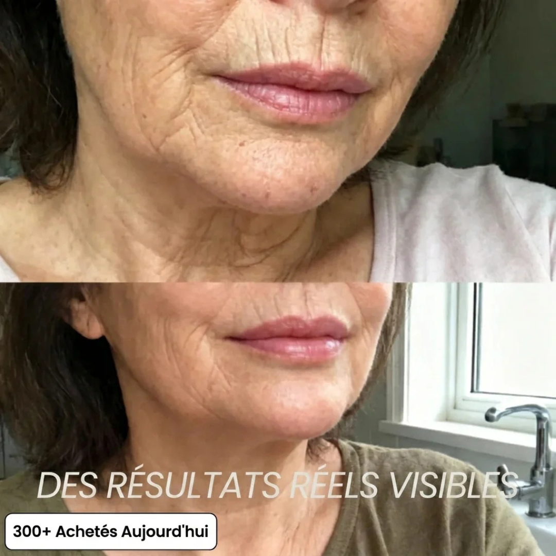 Stick collagène PDRN anti-âge visage