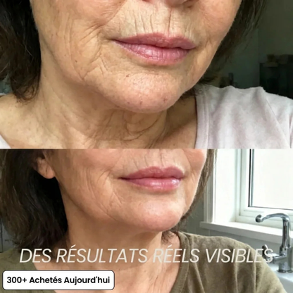 Stick collagène PDRN anti-âge visage