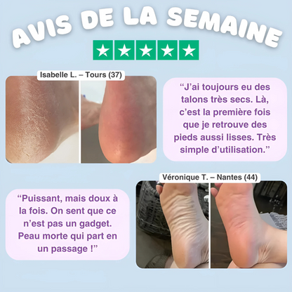 Râpe Électrique Rechargeable pour Pieds