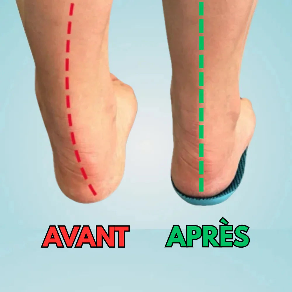 Semelles orthopédiques anti-douleur pour pieds sensibles