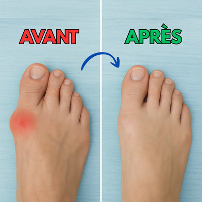 Semelles orthopédiques anti-douleur pour pieds sensibles