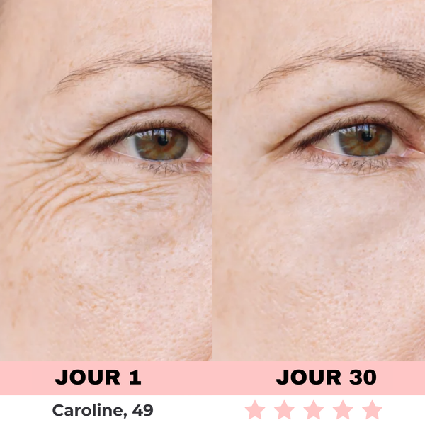 LED-Lichtgerät zur Hautpflege