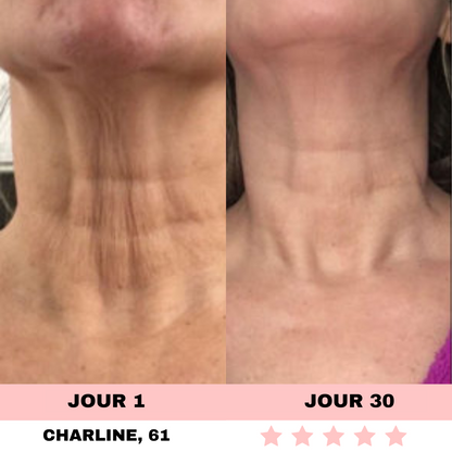 LED-Lichtgerät zur Hautpflege