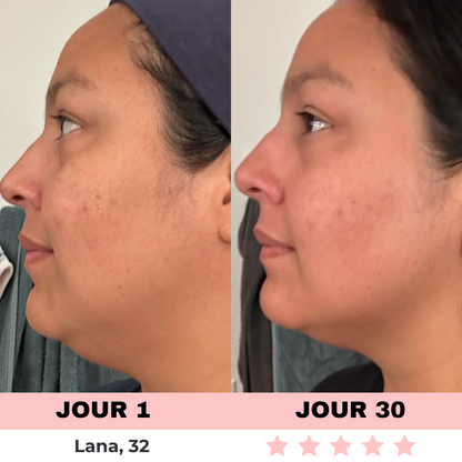 LED-Lichtgerät zur Hautpflege