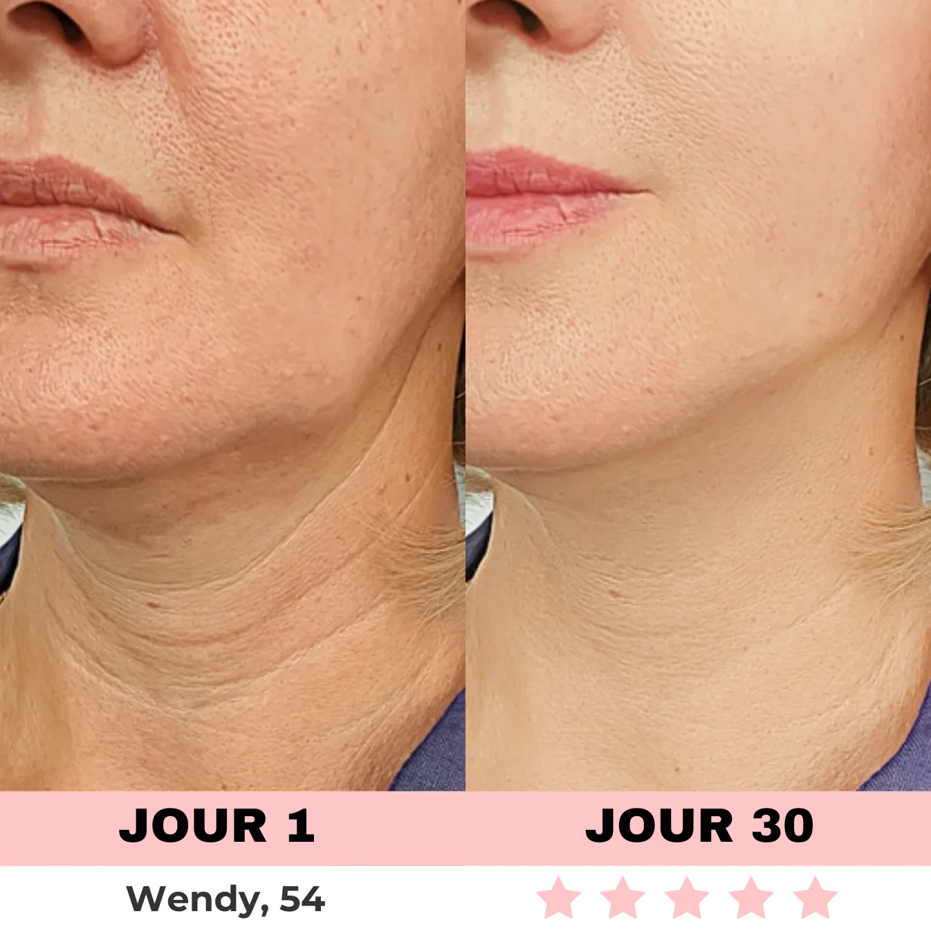 LED-Lichtgerät zur Hautpflege