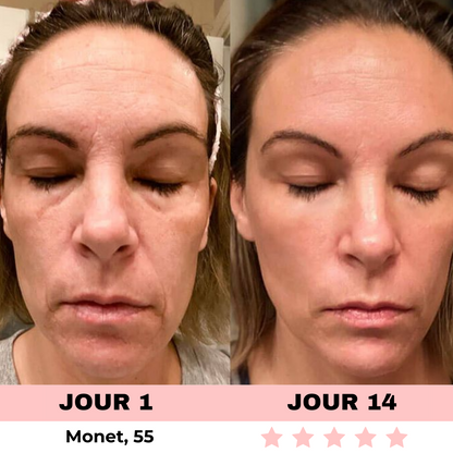 LED-Lichtgerät zur Hautpflege