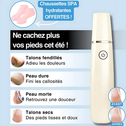 Râpe Électrique Rechargeable pour Pieds