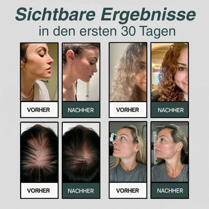 Hochdruck-Filterbrause
