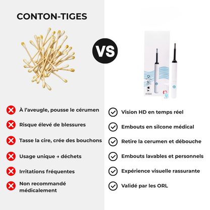 Otoscope Connecté Caméra HD