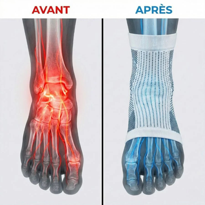 Chaussettes de Compression Apaisantes