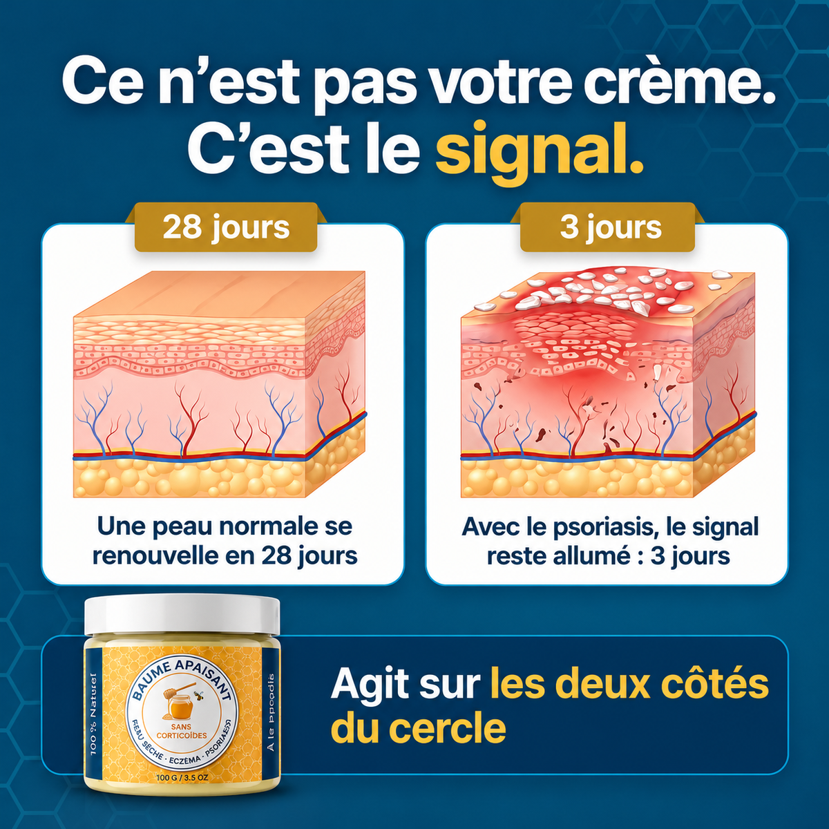 Baume Naturel Apaisant Psoriasis au Propolis