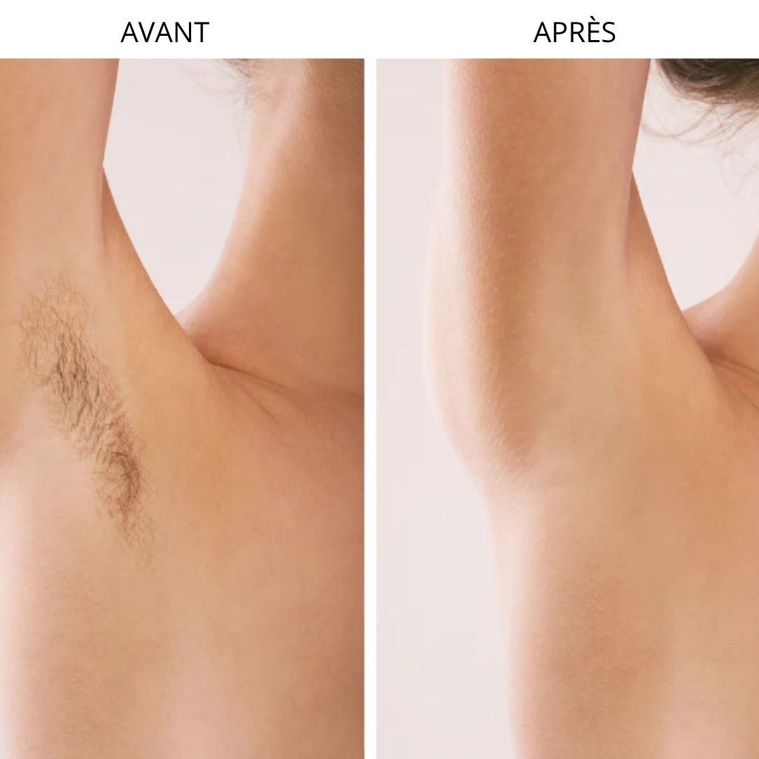 Rasoir électrique indolore pour une épilation douce et efficace