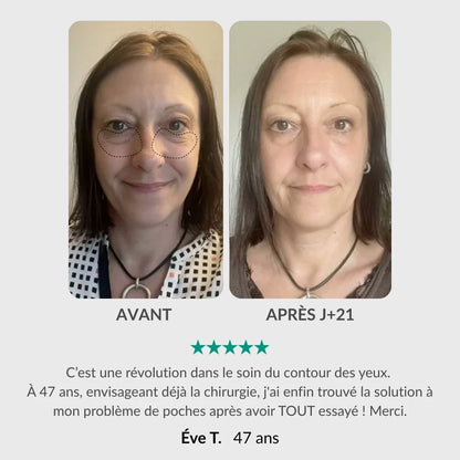 Stylo & Sérum Contour des Yeux