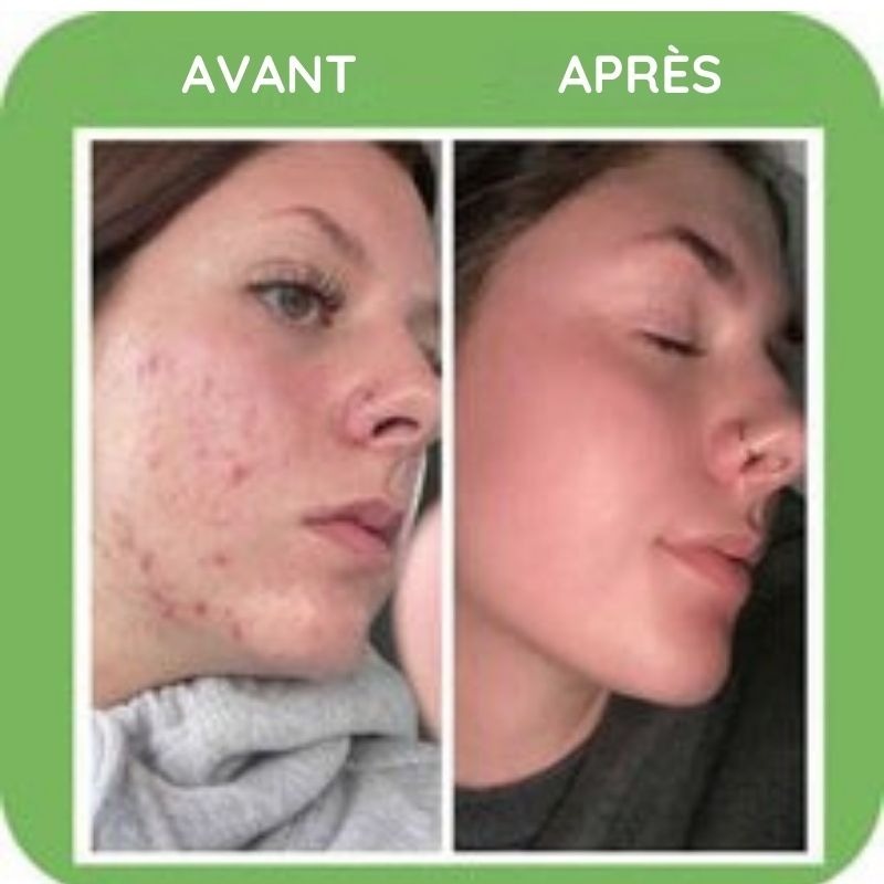 Reinigende Maske mit grünem Tee