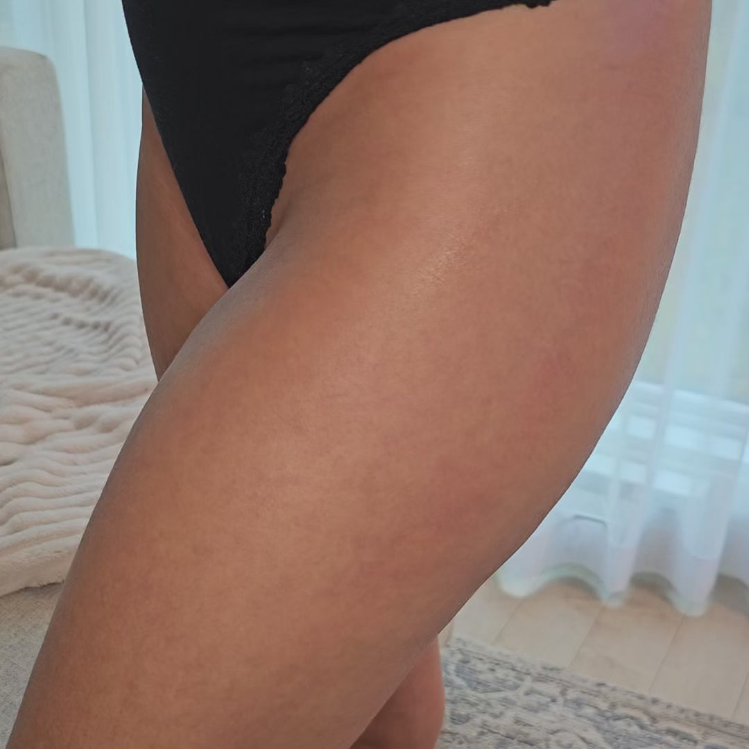 Masseur Anti-Cellulite