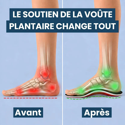 Semelles Orthopédiques Pieds Plats