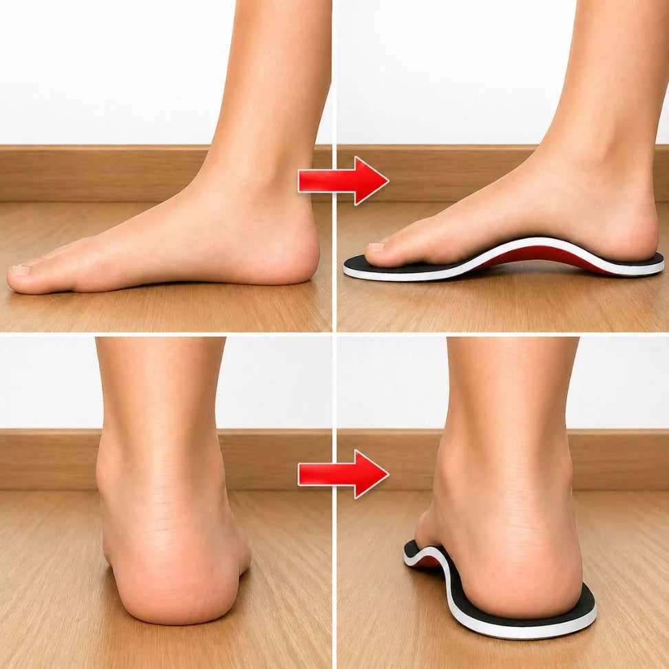Semelles Orthopédiques Pieds Plats