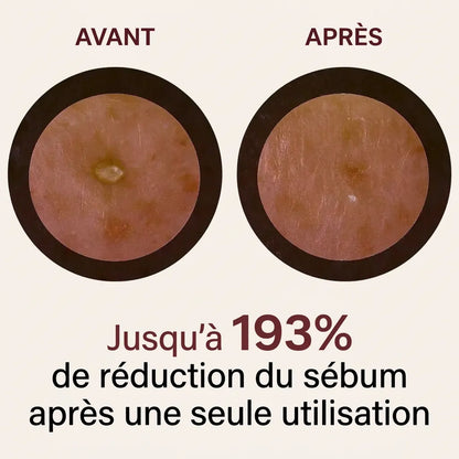Sérum Gommant au Riz – Pour Peaux Sensibles