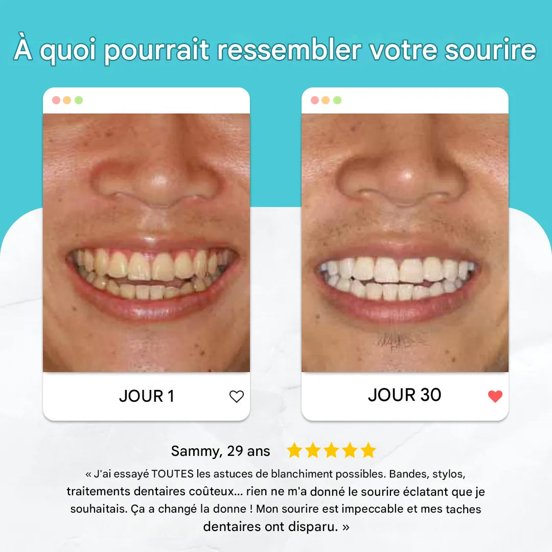 Automatische 360°-Bürste