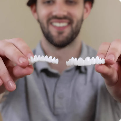 Facettes dentaires souples à clipser – Sourire immédiat sans douleur