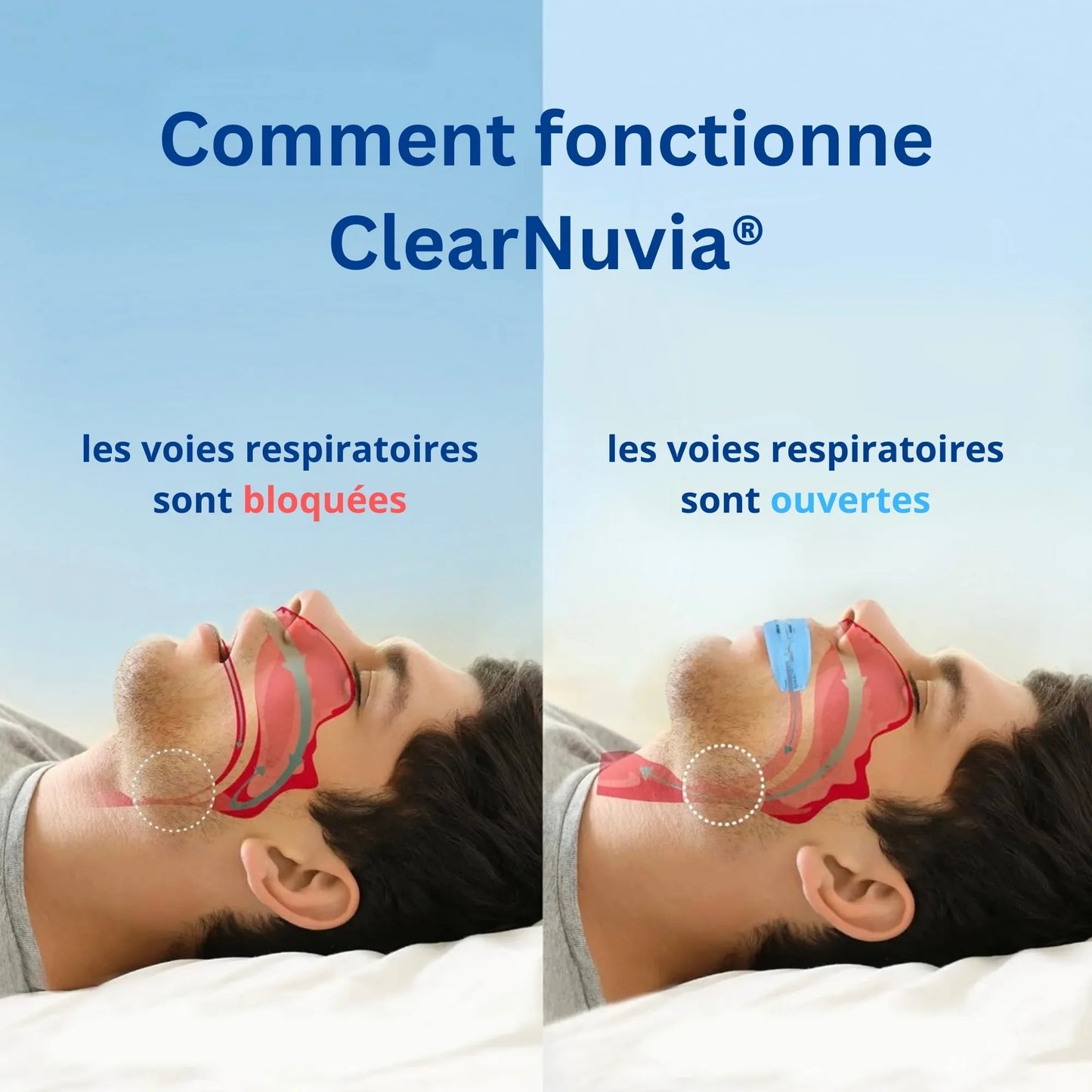 Dilatateur Nasal Anti-Ronflement – Stopper le Ronflement dès la Première Nuit