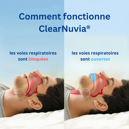 Dilatateur Nasal Anti-Ronflement – Stopper le Ronflement dès la Première Nuit