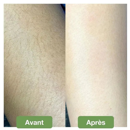 Gomme d’Épilation Douce