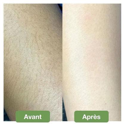 Gomme d’Épilation Douce